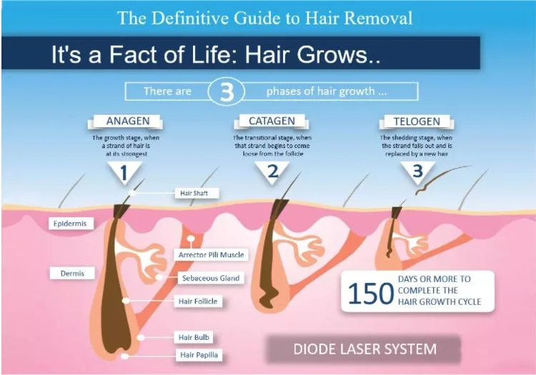 CE Approved Germany Bars 808nm Diode Laser Hair Removal Machine